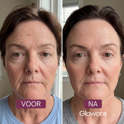 DERMALYX® - Masque bio-collagène + Pinceau